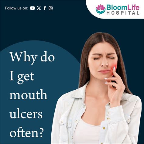 how to get rid of ulcers in mouth 11