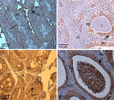 Images of the immunolocalization of β hexosaminidase Hex A in the