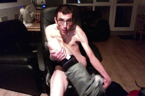 Free Porn Cerebral Palsy