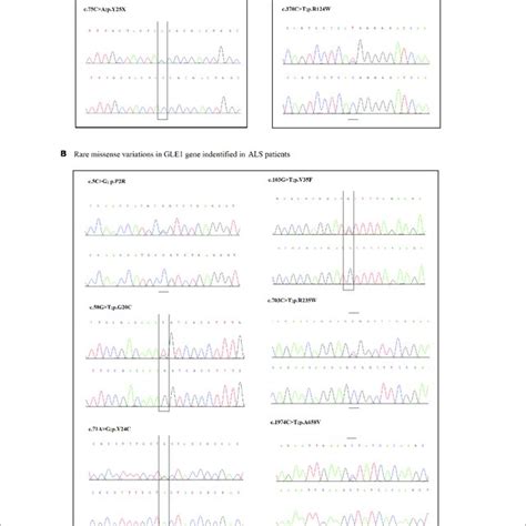 A The Sanger Sequencing Of The LOF Variant Identified In SALS