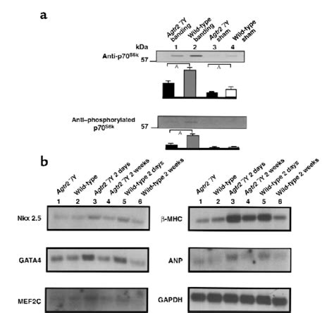 A Phosphorylated P S K And Total P S K In The Agtr Y And