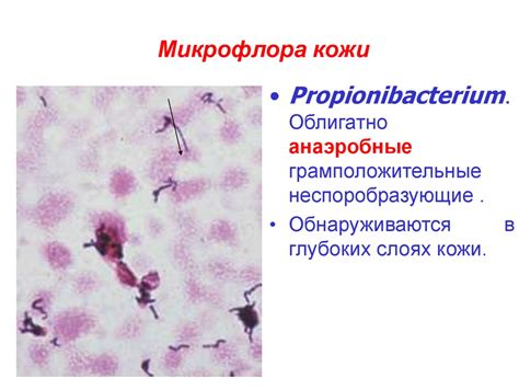 Микрофлора тела человека - презентация онлайн