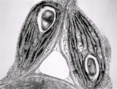 Labelled Chloroplast Micrograph