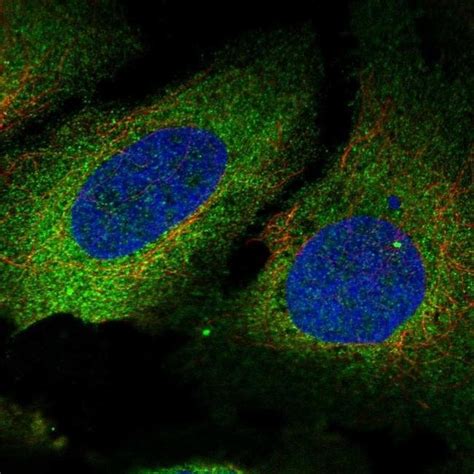 Pls Polyclonal Antibody Invitrogen L Unconjugated Fisher