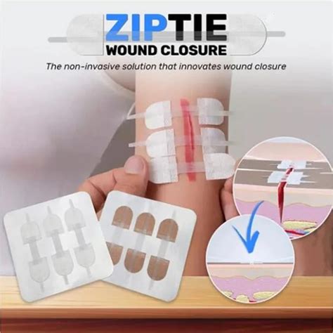 Zip Tie Wound Closure Patch Band Aid Hemostatic Adhesive Aid Emergency