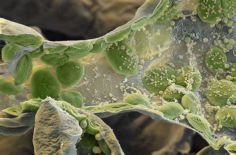 Chloroplasts / Chloroplasten | Microscopic photography, Things under a ...