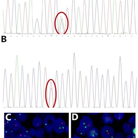 Representative Sanger Sequencing Images Of IDH Mutation TERT Promoter