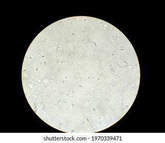 Semen Analysis Sperm Analysis On Microscopic Stock Photo 1970339471