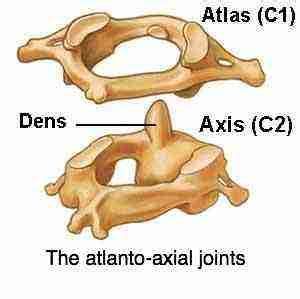 Atlanto axial joint anatomy considers a most vital joint in the neck.