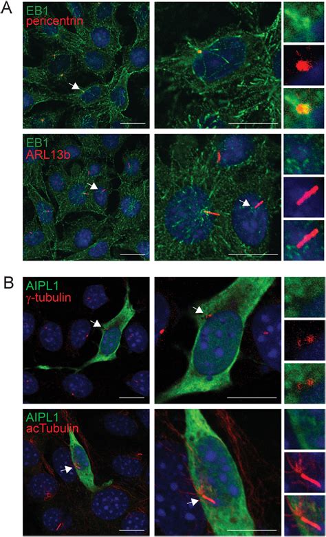 Eb1 But Not Aipl1 Localizes To Primary Cilia In Arpe 19 Cells A Download Scientific Diagram