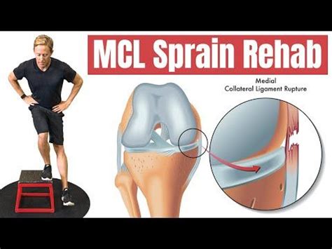 Mcl tear 4 exercises to rehab your knee – Artofit