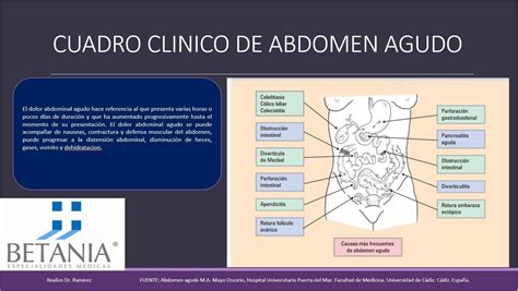 Infograf A Sobre Abdomen Agudo Dr Ram Rez Oncologiabetania