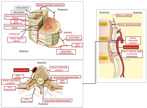 Arteria Espinal Anterior