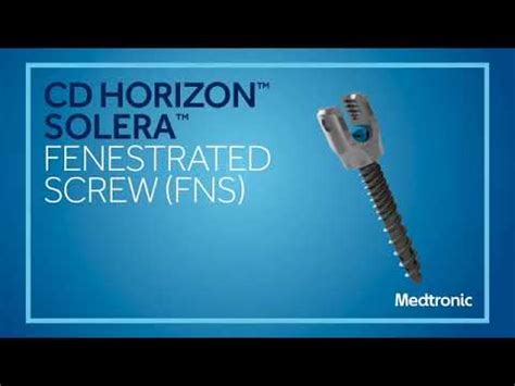 Medtronic CD Horizon Solera Fenestrated Screw FNS Animation YouTube