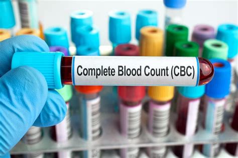 CBC Explained 5 Things To Know About A Complete Blood Count Test