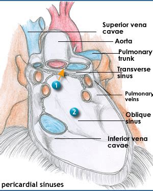 Transverse Pericardial Sinus