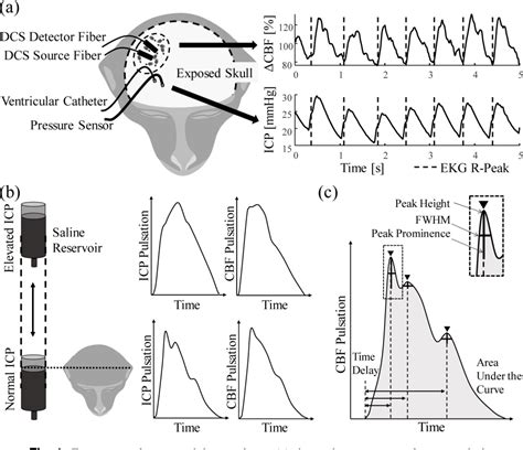 Figure 1 From Estimating Intracranial Pressure Using Pulsatile Cerebral