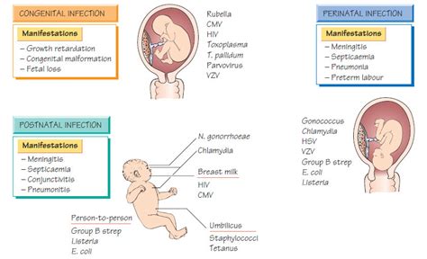 Congenital And Perinatal Infections Systemic Infection Medicinal