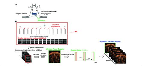 Experimental Setup Of Dynamic Ultrafast Doppler A Schematic