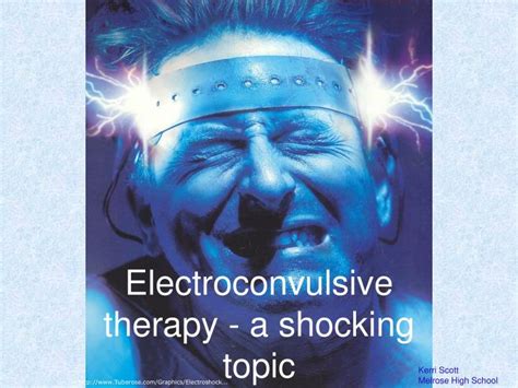 Ppt Electroconvulsive Therapy A Shocking Topic Powerpoint