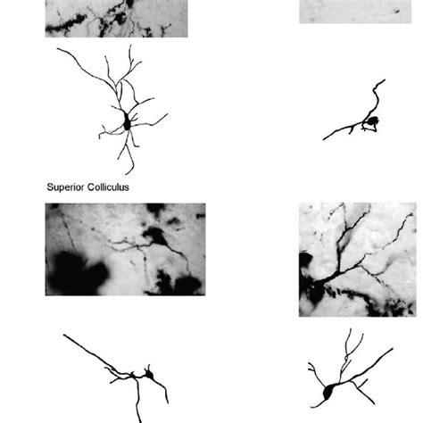 Different Effects Of Chronic Stress On The Neuronal Morphology Of The