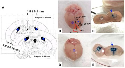 Intracerebroventricular Injection Of Amyloid Peptides In Normal Mice