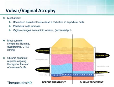 Vulvar Vaginal Atrophy Vva