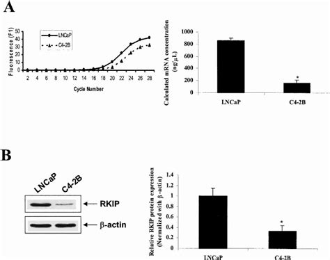 Differential Expression Of Raf Kinase Inhibitor Protein RKIP In Human