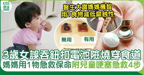 兒童哽塞｜3歲女誤吞鈕扣電池險喪命 媽媽用1食物急救保命獲醫生大讚