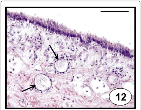 Naked Sporozoites Arrow Resembling Porospora Gregarine Encapsulated