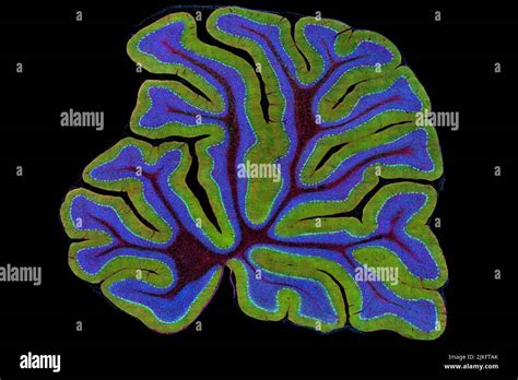 Das Zerebellum Einer Maus Ist Hier Im Querschnitt Dargestellt Das