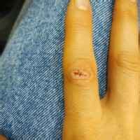 Пластырь Hartmann Cosmos Незаметный для небольших ран - «Cosmos ...