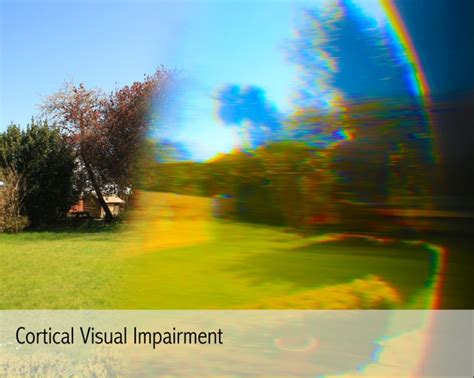 Cortical Visual Impairment - 4Sight Vision Support