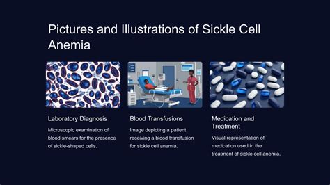 Oral Health And Sickle Cell Anaemia Pptx