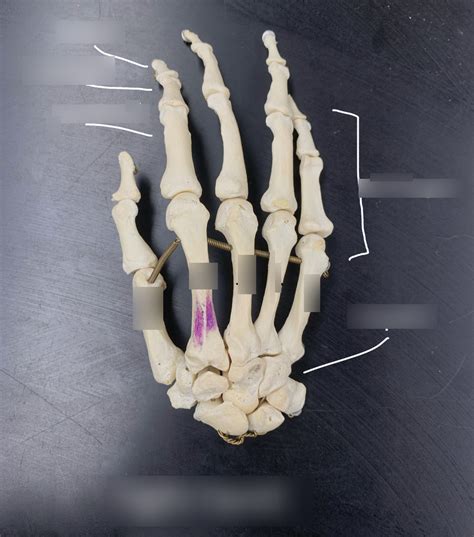 Anatomy Physiology Bone Markings Diagram Quizlet