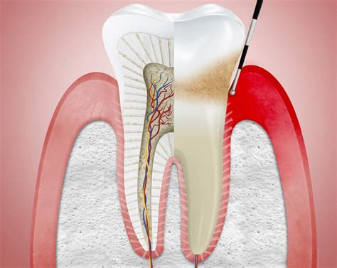 Periodoncia Tratamiento de encías tejidos blandos y duros