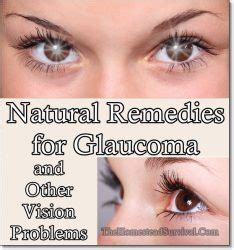 Natural Remedies for Glaucoma and Other Vision Problems - The Homestead Survival