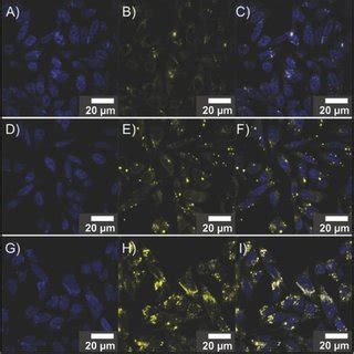 Confocal Images Of Hela Cells Incubated With A Mg Ml Dispersion