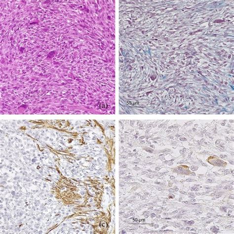 Photomicrographs Of Feline Undifferentiated Pleomorphic Sarcoma A