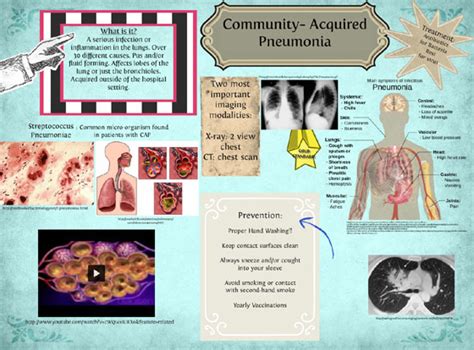 Community Acquired Pneumonia | Aspiration Pneumonia Ttreatment ...