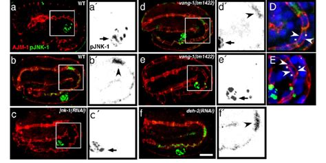 JNK 1 Is Phosphorylated Specifically In The C Elegans Intestine During