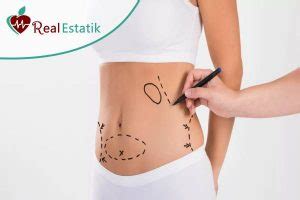 Tummy Tuck Surgery In Turkey Abdominoplasty In Turkey REAL ESTATIK