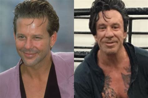 Mickey Rourke Irriconoscibile E Con Sospetto Parrucchino Il Tramonto Del Sex Symbol