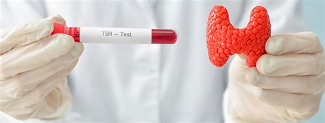 Thyroid Function Testing and Thyroid Nodules – CEEI