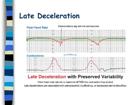 Ppt Fetal Monitoring Powerpoint Presentation Free Download Id 1115826