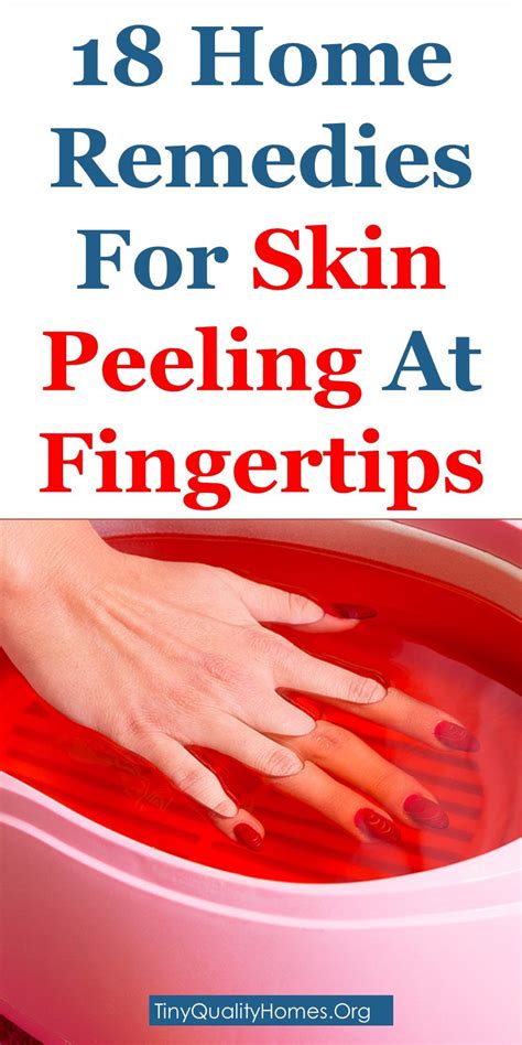 18 Home Remedies To Get Rid Of Skin Peeling At Fingertips With Images