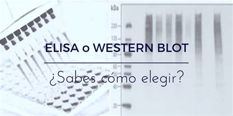 Elisa Assay Vs Western Blot Sandexpress