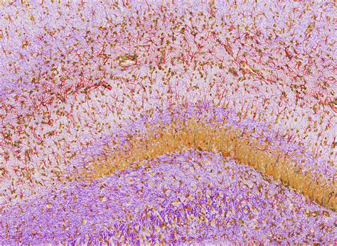 Hippocampus brain tissue - Stock Image - P360/0471 - Science Photo Library 