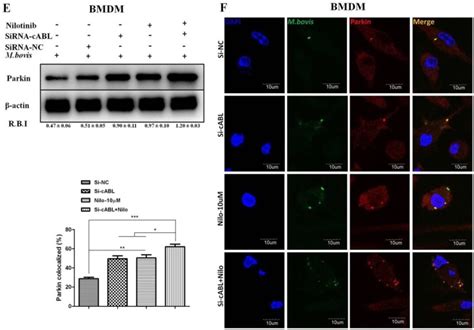 Nilotinib A Tyrosine Kinase Inhibitor Mediates Resistance To