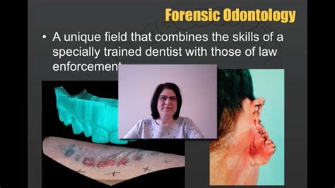 Forensic Odontology Youtube